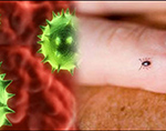 Congo Virus- Perils  & Remedies