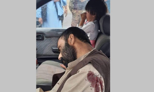 Man Shot Dead in Broad Daylight, In Front of His Infant Daughter in Kandahar