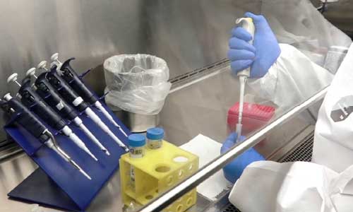 76 New Cases of  COVID-19 Reported