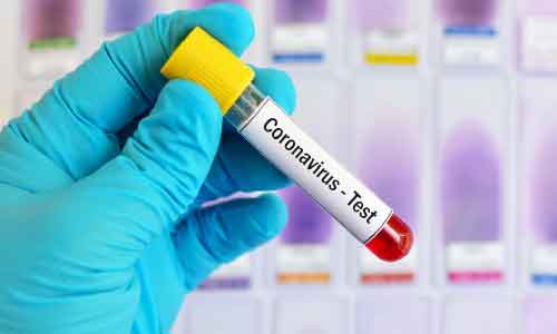 Afghanistan Coronavirus Updates: 34,194 Cases, 971 Deaths